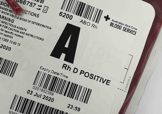 krew-podczas-porodu-ile-tracimy-i-kiedy-to-moze-byc-niebezpieczne