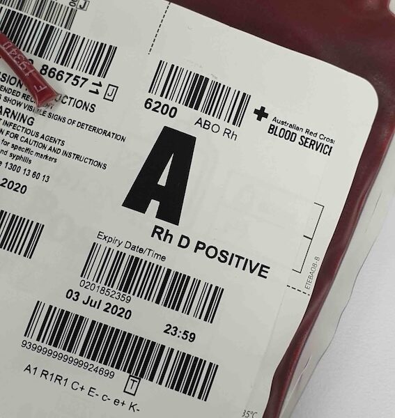 krew-podczas-porodu-ile-tracimy-i-kiedy-to-moze-byc-niebezpieczne